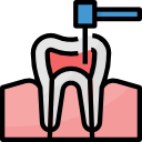 Root Canal Treatment (Endodontics) - Yap & Associates Dental Specialist Clinic