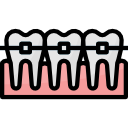 Teeth Braces (Orthodontist Malaysia) - Yap & Associates Dental Specialist ClinicTeeth Braces (Orthodontist Malaysia) - Yap & Associates Dental Specialist Clinic